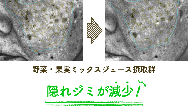 野菜・果実ミックスジュース摂取群隠れジミが減少