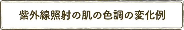 紫外線照射の肌の色調の変化例
